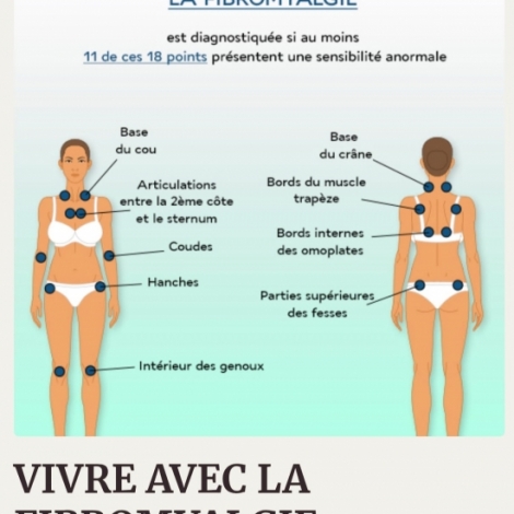 Maladie encore assez mconnue, on parle de la fibromyalgie dans la chronique sant du jour sur RMB
